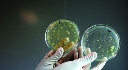 食品大肠杆菌怎么检测？食品中大肠杆菌的检测方法